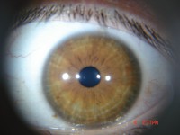 /album/iridonaturobiologia/a4-olho-fotos-beth-para-artigo-002-jpg1/